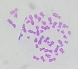 Micrograph of human male chromosomes using Giemsa staining for G banding.