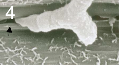 Penetration of a wheat leaf stoma (arrow) by a pycnidiospore germ tube of Zymoseptoria tritici.