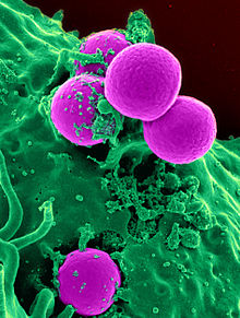 Colorized scanning electron micrograph of a human neutrophil ingesting MRSA