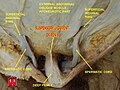 Suspensory ligament of penis.