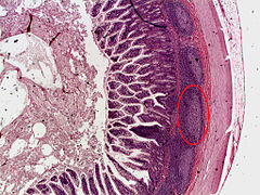Cross section of ileum with a Peyer's patch circled.