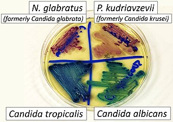 CHROMAgar (a chromogenic agar) with its distinctive presentation of some major fungal pathogens.