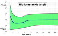 Hip-knee-ankle angle by age, with 95% prediction interval[10]