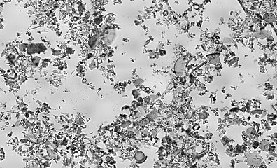 Diatomaceous earth is a soft, siliceous, sedimentary rock made up of microfossils in the form of the frustules (shells) of centric and pennate diatoms (click to magnify)