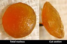 Front and side views of a highly opacified extracted cataract. It is uniformly yellow in colour.