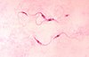 Photomicrograph of Trypanosoma cruzi parasites