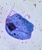 Trichomonas vaginalis May-Grünwald staining