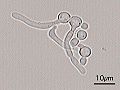 Candida Albicans Hyphal forms (filamentous projections called hyphaes emerging from round-to-oval forms)