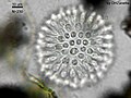 Sphaeroeca colony (approx. 230 individuals) under light microscopy.