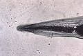 This micrograph reveals the cephalic alae in the head region of E. vermicularis.