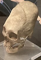 Female skull found in Mozs, Hungary, c. 5th century