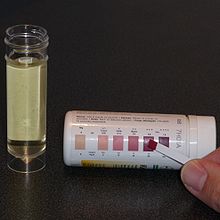 A test strip with a single pad is held up to a color chart on the test strip container. The test strip is a deep purple color, which corresponds to a result of 3+.