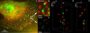 3D dual-color super-resolution microscopy with Her2 and Her3 in breast cells, standard dyes: Alexa 488, Alexa 568. LIMON microscopy