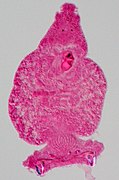 Use of carmine as a staining agent in histology (here on a flatworm)