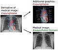 Derivative of medical imaging Attribution-Share Alike 3.0 Unported license, attributed to Mikael Häggström, ZooFari, Stillwaterising and Gray's Anatomy creators