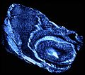 Polarised light microscopy image of the annulus fibrosus, showing the concentric layers of fibrous tissue
