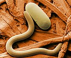 Colored SEM image of soybean cyst nematode and egg. The artificial coloring makes the image easier for non-specialists to view and understand the structures and surfaces revealed in micrographs.