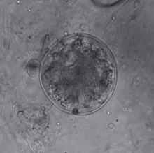 Differential interference contrast image of a spizellomycete chytrid thallus consisting of a large sphere filled with amorphous, bubbly cytoplasm and a much smaller, empty sphere to the left of the large sphere.