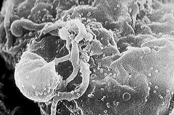 Scanning electron micrograph of HIV budding from lymphocytes