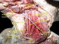 Muscles, arteries and nerves of neck. Newborn dissection.