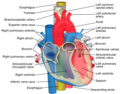 Image showing main pulmonary artery coursing ventrally to the aortic root and trachea, and the right pulmonary artery passes dorsally to the ascending aorta, while the left pulmonary artery passes ventrally to the descending aorta.