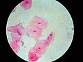 Human cheek cells (nonkeratinized stratified squamous epithelium) 500×