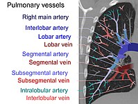 On CT scan, pulmonary emboli can be classified according to the level along the arterial tree.