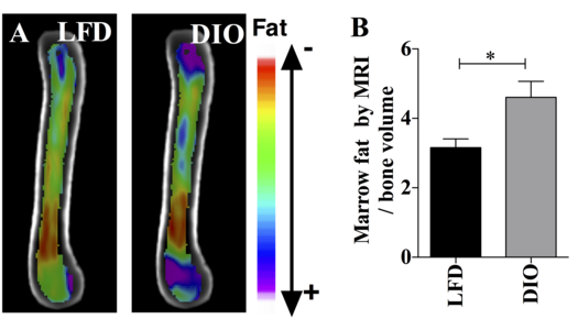 This figure demonstrates the use of MRI imaging (9.4T scanner) along with advanced image processing to quantify BMAT. The images and graph demonstrate that BMAT is higher in obese compared with lean mice. B6 mice were fed HFD from age 4 wk until age 16 wk. BMAT was quantified by MRI. A) n=10 superimposed group average images are shown B) BMAT normalized to bone volume in each group.