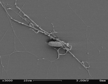 Aplanochytrium, SEM showing one vegetative cell and extended ectoplasmic network.