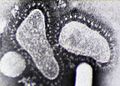 Zwei sehr gut erkennbare, nicht näher bezeichnete Coronaviren mit den für Coronaviren typischen Fortsätzen. Beide nicht typisch kreisrund, sondern pleomorph. Die Form des linken erinnert auffällig an einen linken Fußabdruck. Das rechte ist etwa kartoffelförmig. Unten rechts die Spitze eines stabförmigen, dichten Objektes, dessen abgerundete Spitze die Hülle des rechten Partikels einzudrücken scheint. Vermutlich ein Nanotubus, der zum Anstupsen und deformieren von Viren benutzt wird.