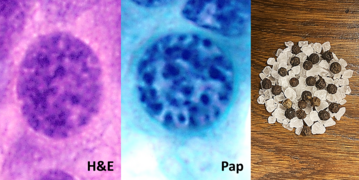 H&E stain, Pap stain, and comparison to salt and pepper