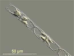 Guinardia delicatula, a diatom responsible for algal blooms in the North Sea and the English Channel[161]