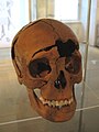 Skull of a 20- to 30-year-old decapitated woman of the 3rd century AD. Cutting marks above the right eye hole show the head has been scalped.