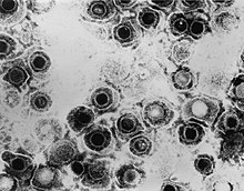 TEM micrograph of virions of a herpes simplex virus species