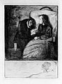 Das kranke Kind (Kaltnadelradierung, 1894)