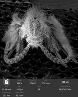 high resolution SEM image of Psychodidae (drain- or moth flies), front view