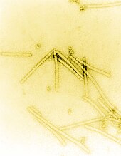 Electron micrograph of rod shaped TMV particles