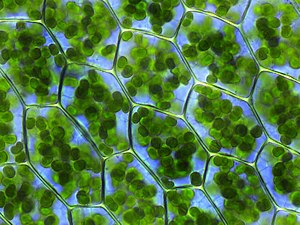 A microscope image of plant cells, with chloroplasts visible as small green balls