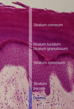 Epidermal layers. Attribution 3.0 Unported licensing, attributed to Wbensmith and Mikael Häggström