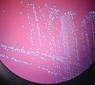 Aerococcus urinae - colonies