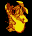 A 3D Power Doppler image of vasculature in 20-week placenta