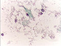 The cytoplasms of squamous epithelial cells melted out; many Döderlein bacilli can be seen.