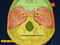 The anterior, middle and posterior cranial fossa in different colors