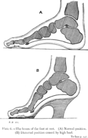 Plantar flexion of the foot in high heels