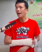 acitivist gives interview with his broken arm from an assault.