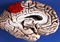 Medial surface of left cerebral hemisphere. (Precuneus colored in red.)