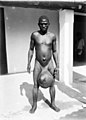 Afrikaner mit Genitalelephantiasis, 1906