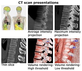 CT scan presentations