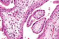 Micrograph showing chorionic villi. Very high magnification. H&E stain.