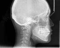 An X-ray taken for skull analysis